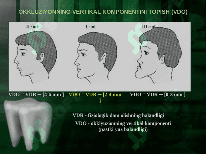 Markaziy okklyuziyani aniqlashda xatoliklar 6