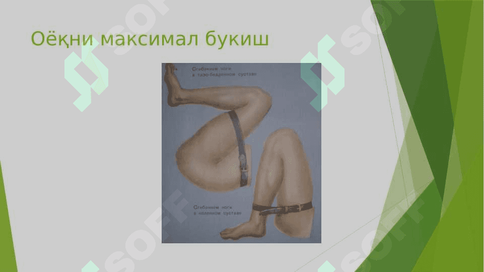 Qon ketishini to’xtatish usullari 8