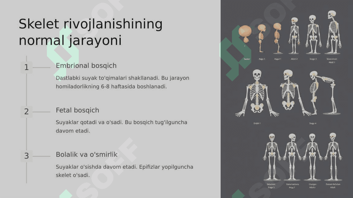 Skeletning rivojlanish anomaliyalari 3