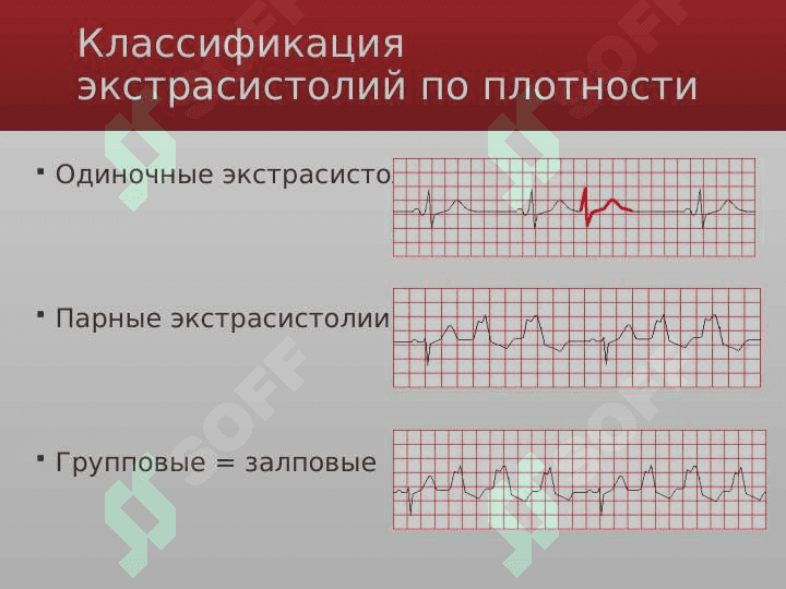 Ekistrasistola (rus) ppt 4