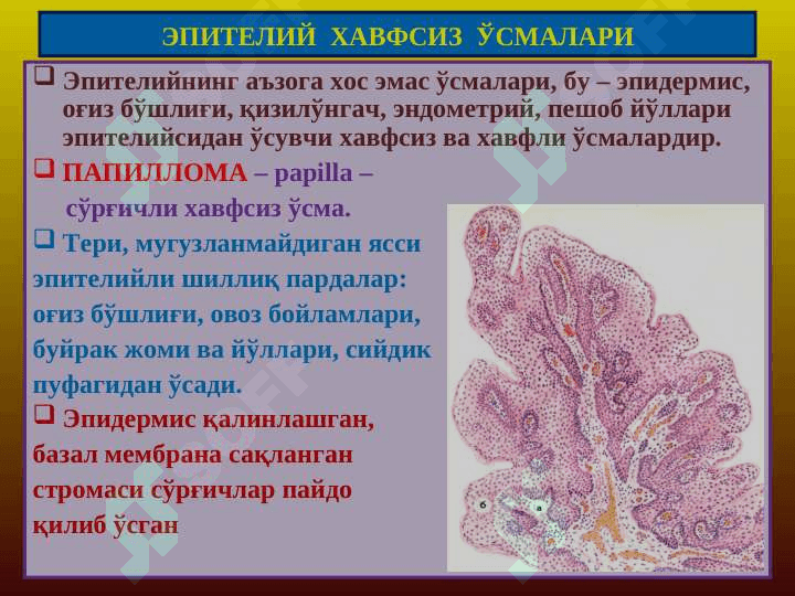 Ўсмалар. Мезенхимал ўсмалар 2