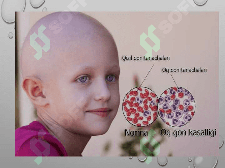 Leykozlar.leykozlar haqida tushuncha.o’tkir leykoz haqida tushuncha. Belgilari, turlari,rivojlanishi 3