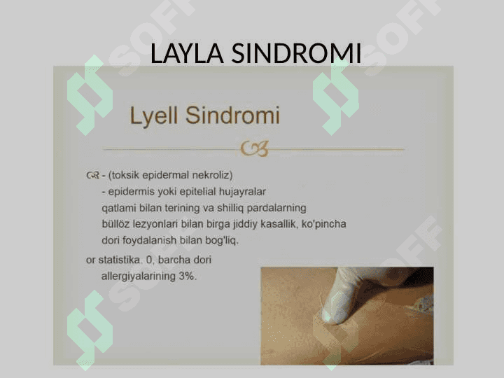 LAYLA SINDROMI 2