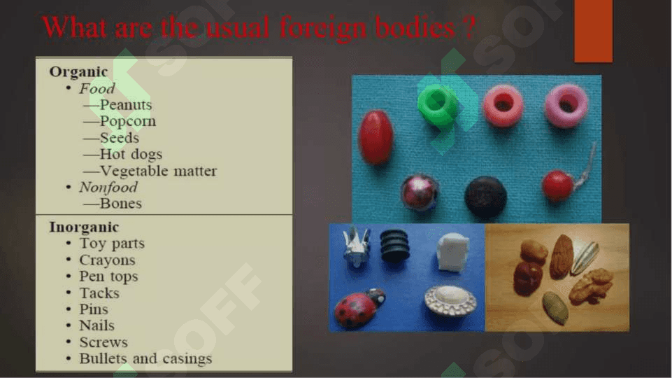Foreign body aspiration, Pneumothorax, empyema 5