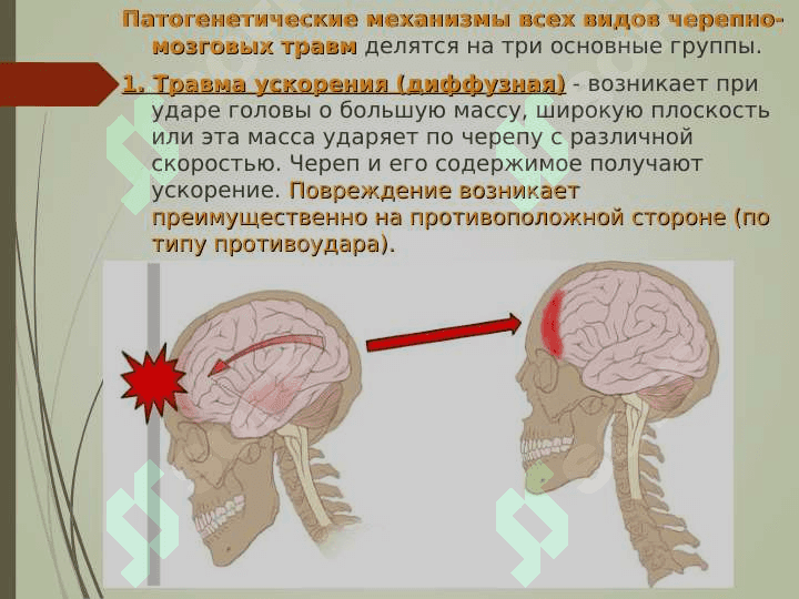 Черепно–мозговая травма 7