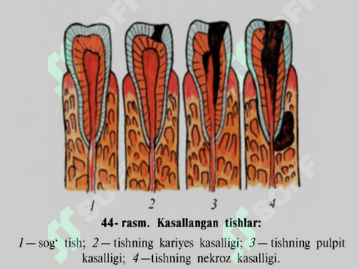 OVQAT HAZM QILISH SISTEMASI ORGANLARI 7