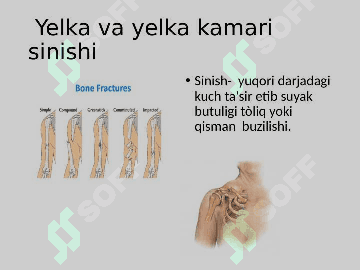 Yelka va Yelka kamari shikastlanishi 4