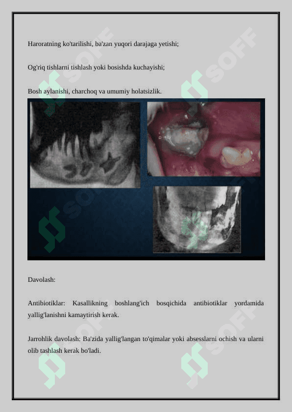 ODONTOGEN O`SMALAR. AMELOBLASTOMALAR KLINIKA VA DIAGNOSTIKASI 3