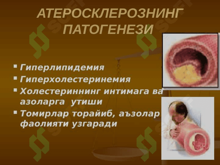 Giperlipoproteinemiyada qo‘llanadigan vositalar. Podagraga qarshi vositalar. Ateroskleroz 6