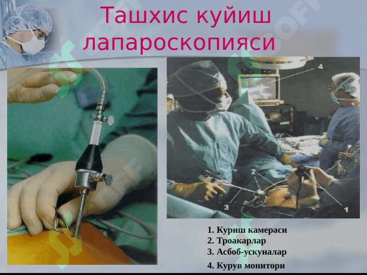 Xirurgik operatsiyalar 5