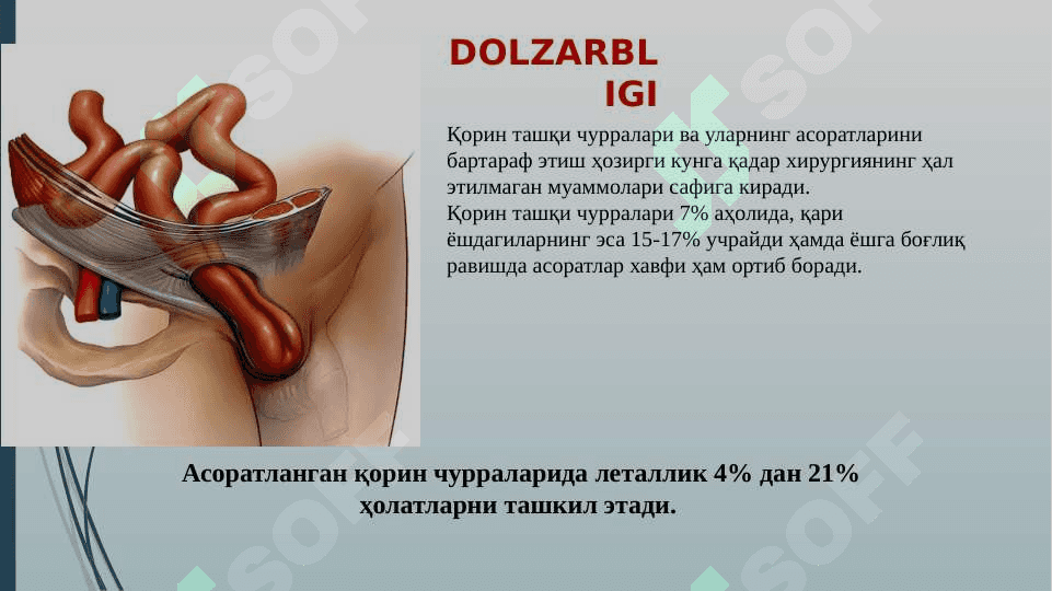 Qorin churralari  va ularning tiurlari. Asoratlari. 2