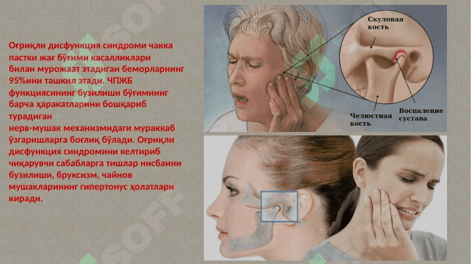 ChPJB ogʻriqli disfunksiya sindromi, osteoartroz. 2