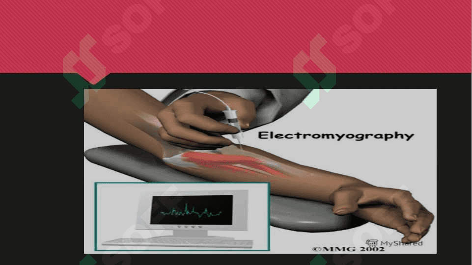 Elektromiografiya, Elektrokardiografiya, Elektrookulografiya 3