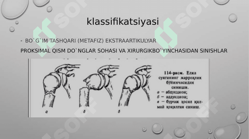 YELKA SUYAKLARINING SINISHLARI VA YELKA SUYAGI BOSHCHASINING CHIQISHI 6