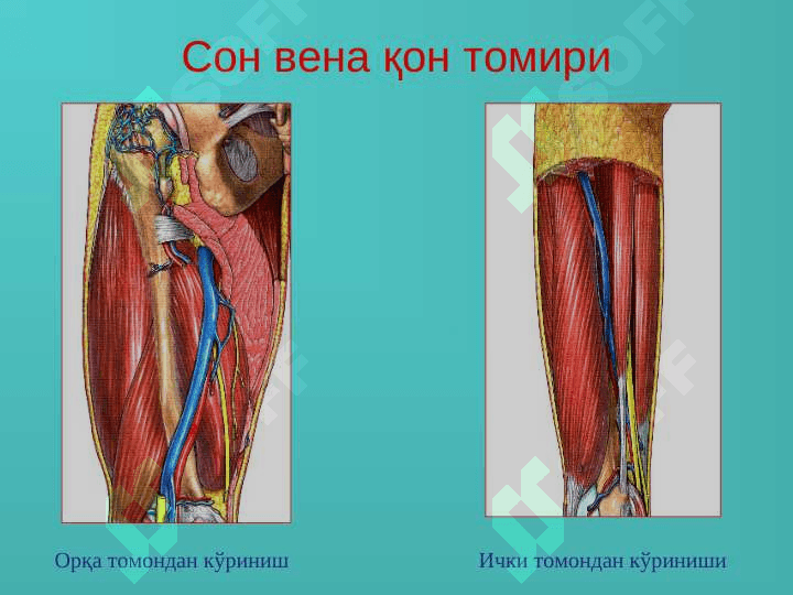 Oyoq venalarining varikoz kasalligi 6