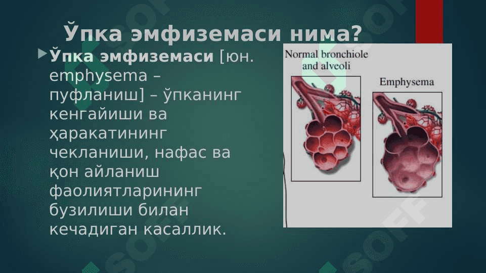O`pka emfizemasi . Ўпка эмфиземаси 2