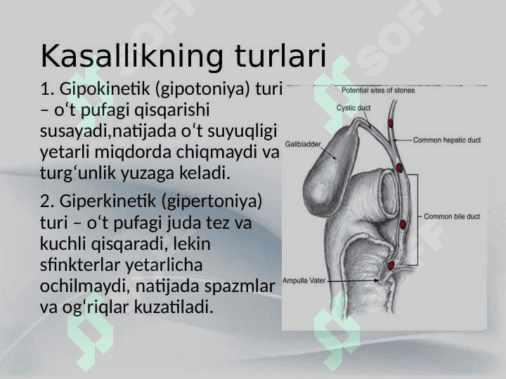 O‘t pufagi diskineziyasi 4