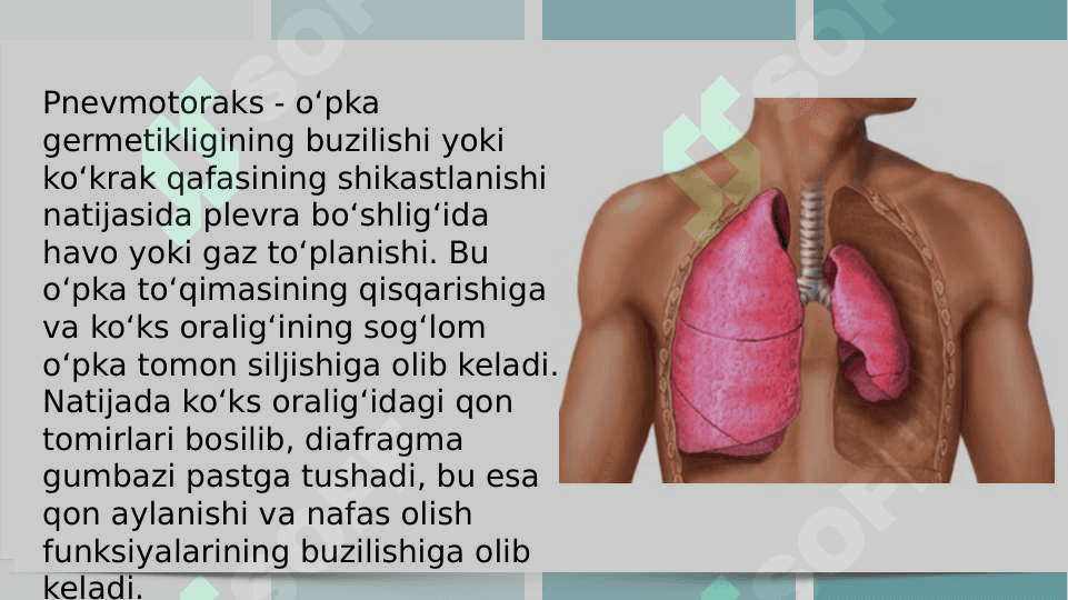 Pnevmatoraks klinika diagnostika davolash slayd 16list 3