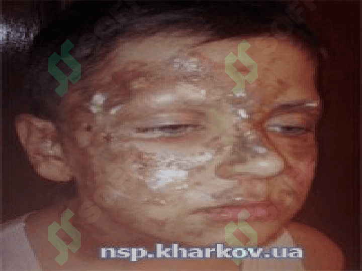 Kuyish 8