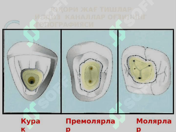 Ildiz kanallariga asbob yordamida ishlov beri 3