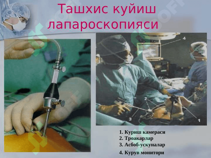 Xirurgik operatsiyalar 5