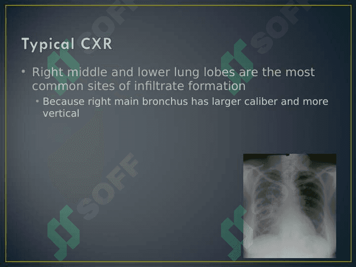 MANAGEMENT OF ASPIRATION PNEUMONIA 6