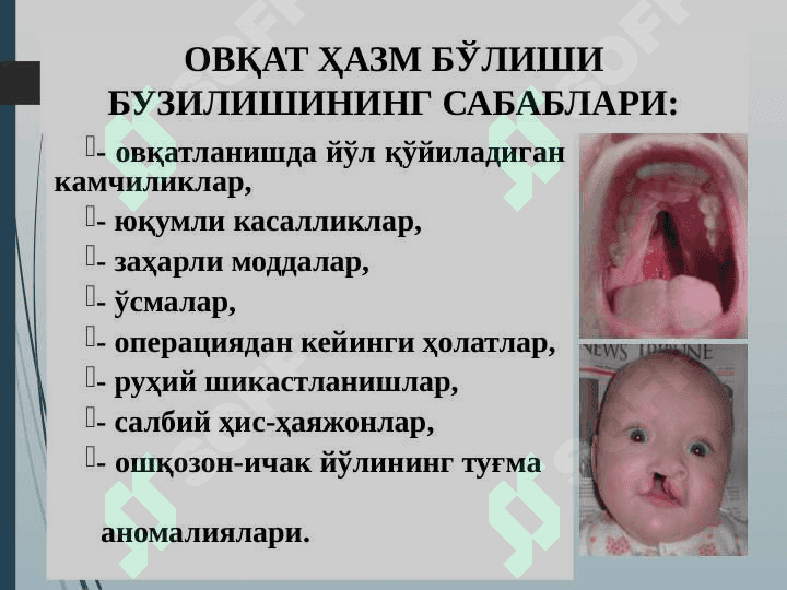 OVQAT HAZM QILISH SISTEMASINING PATOFIZIOLOGIYASI 8