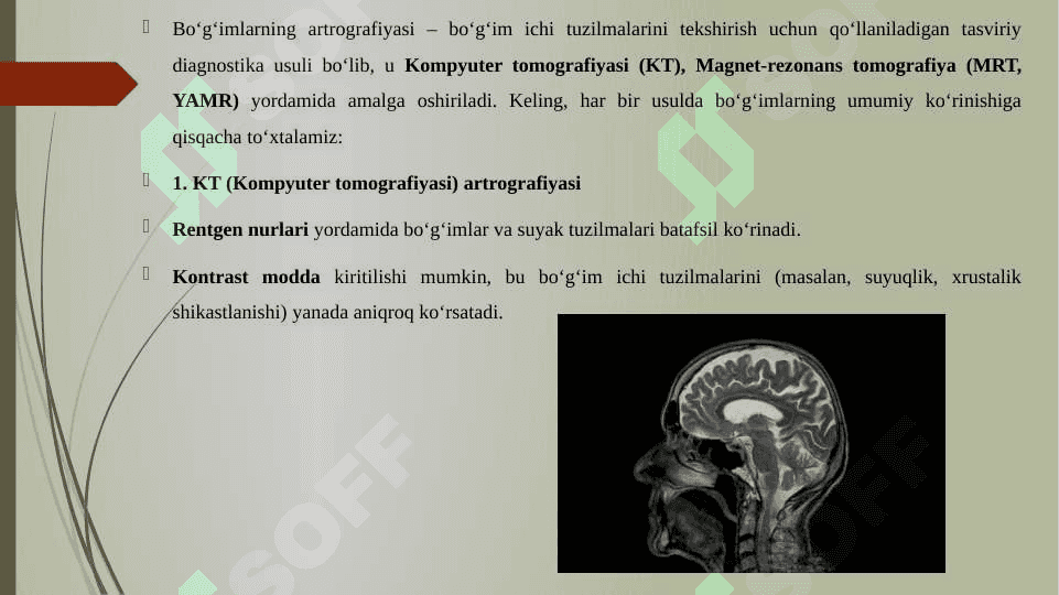 BO'G'IMLARNING ARTROGRAFIYA KT,YAMR,MRT LARDA UMUMIY KO'RINISHI. 3