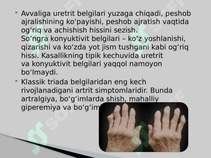 Reaktiv artrit 7