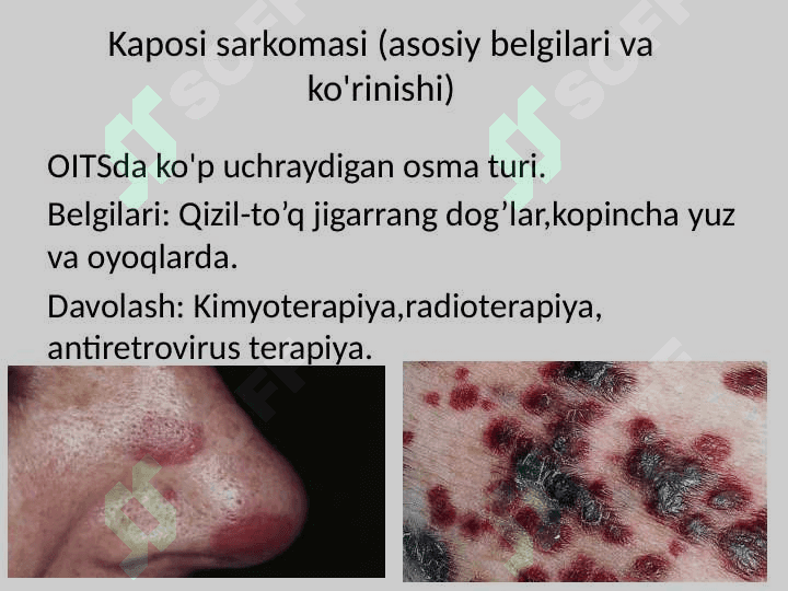 OITSda_Teri_Kasalliklari_Taqdimoti 8
