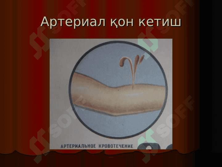 Qon ketishi va uni toʻxtatish usullari 4