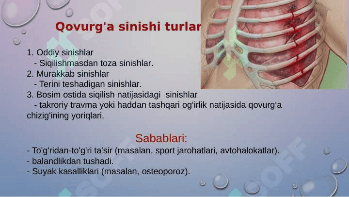 KO‘KRAK QAFASI VA YELKA KAMARI  SHIKASTLANISHLARI 4