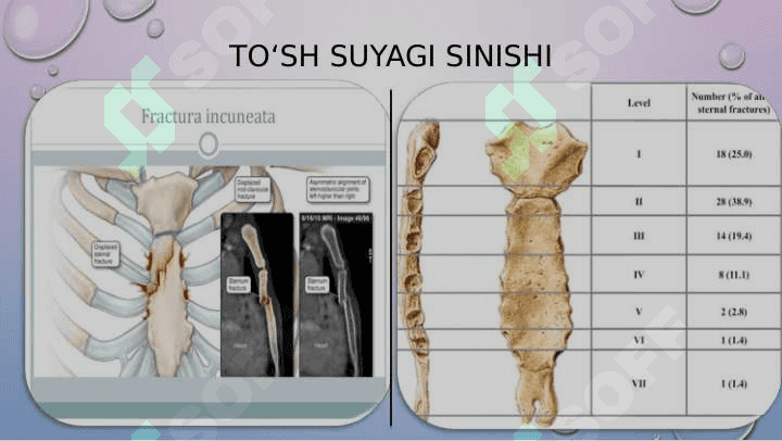KO‘KRAK QAFASI VA YELKA KAMARI  SHIKASTLANISHLARI 8