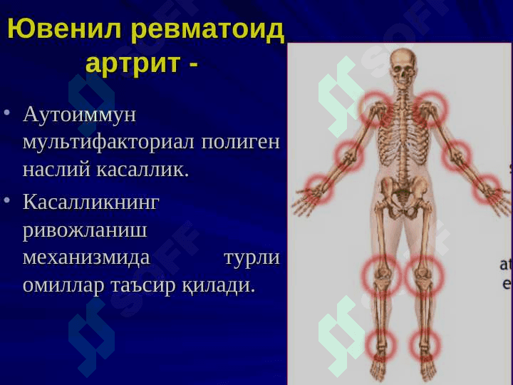 Yuvenil revmatoid artrid . ЮВЕНИЛ РЕВМАТОИД АРТРИТ . JUVENILE RHEUMATOID ARTHRITIS 4