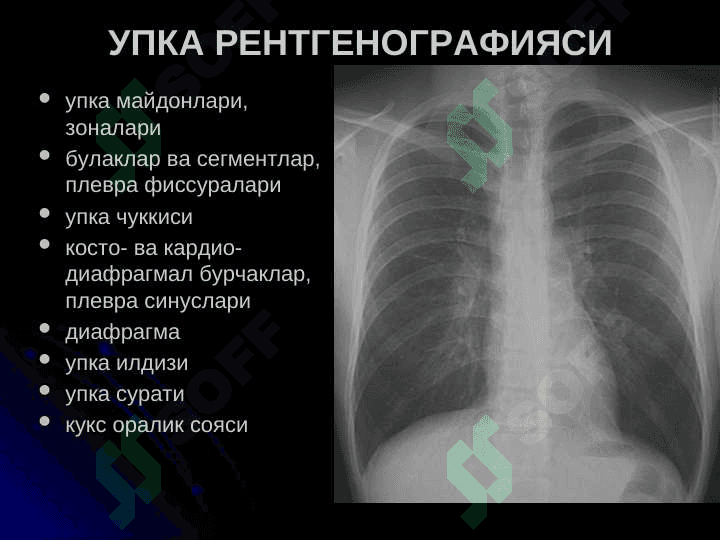 УПКА КАСАЛЛИКЛАРИНИНГ НУР ТАШХИСИ 4