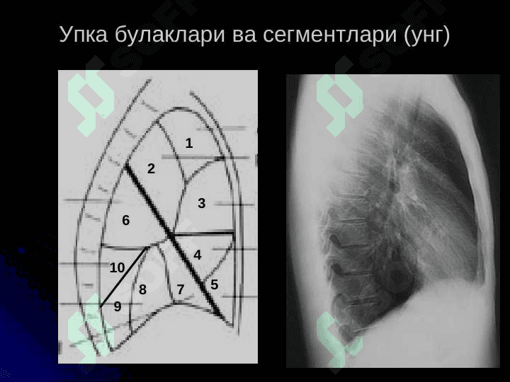 УПКА КАСАЛЛИКЛАРИНИНГ НУР ТАШХИСИ 5