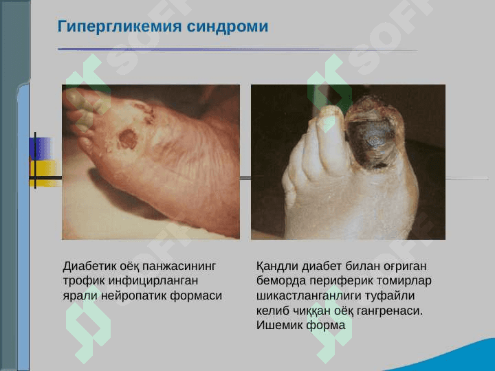 Endokrin tizimi kasalliklari bo`lgan bemorlarni tekshirish .  Qandli diabet , gipo va gipertireozning asosiy klinik simptomlari 8