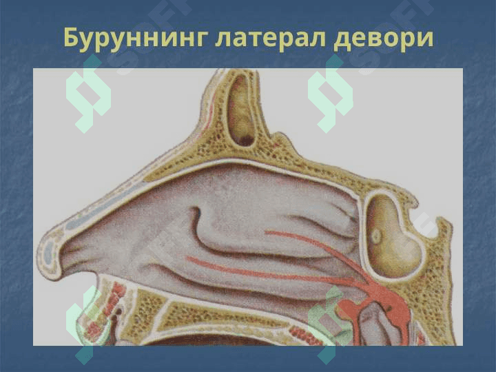 Оториноларингологиянинг замонавий  ютуклари ва вазифалари  Бурун ва бурун Ёндош бушликларининг  уткир ва сурункали касалликлари 8
