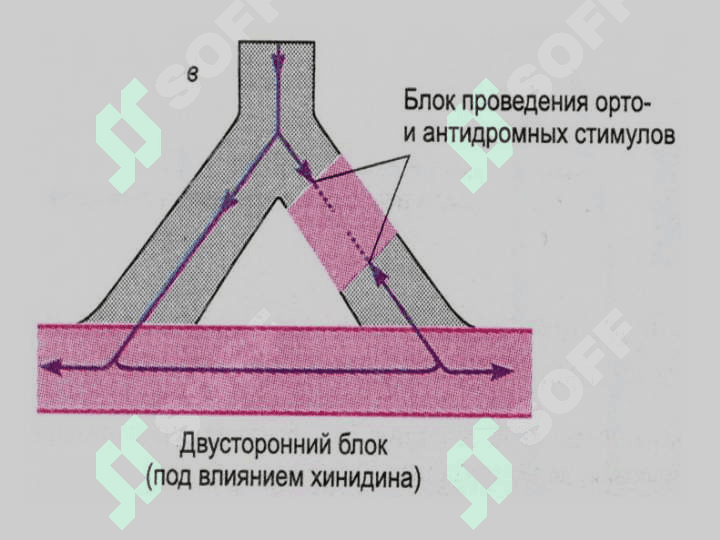 Аритмия 8