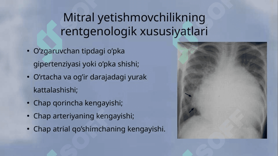 Mirtal qopqoqcha yetishmovchiligi 4