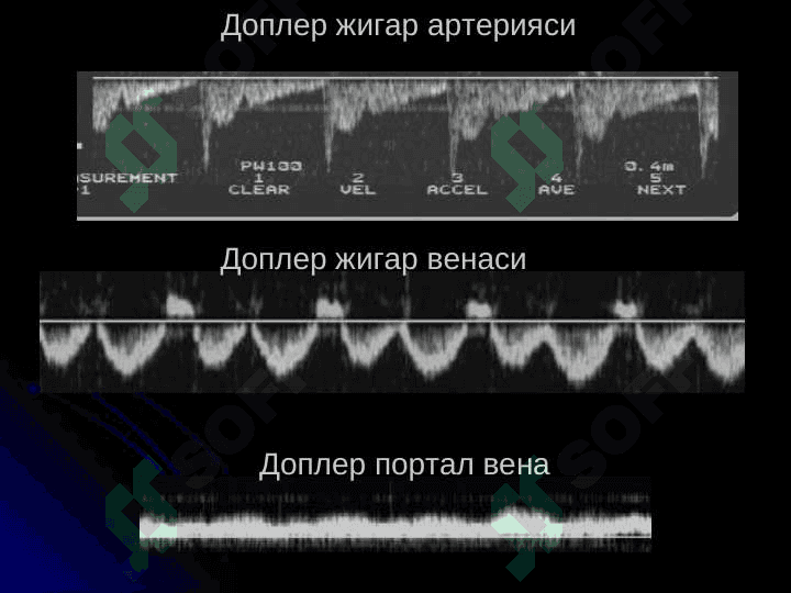 Жигар ва ут йуллари касалликларининг нур ташхиси 5