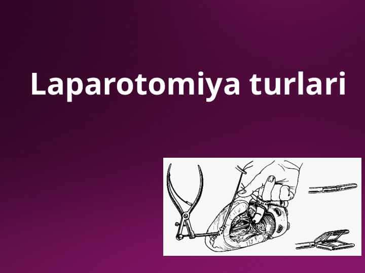 Laparotomiya turlari 1