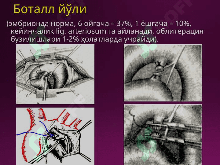 Laparotomiya turlari 2