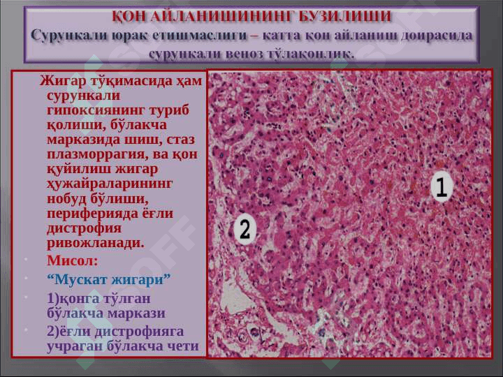 Қон айланишининг бузилиши. Артериал ва веноз тўлақонлик. Қон кетиши”” 8