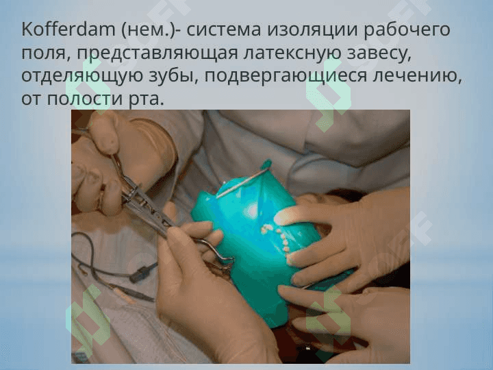 Изоляция зубов коффердамом. 4