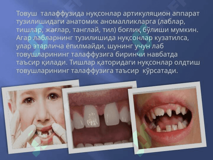 Нутқнинг товуш томонини текшириш технологияси 4