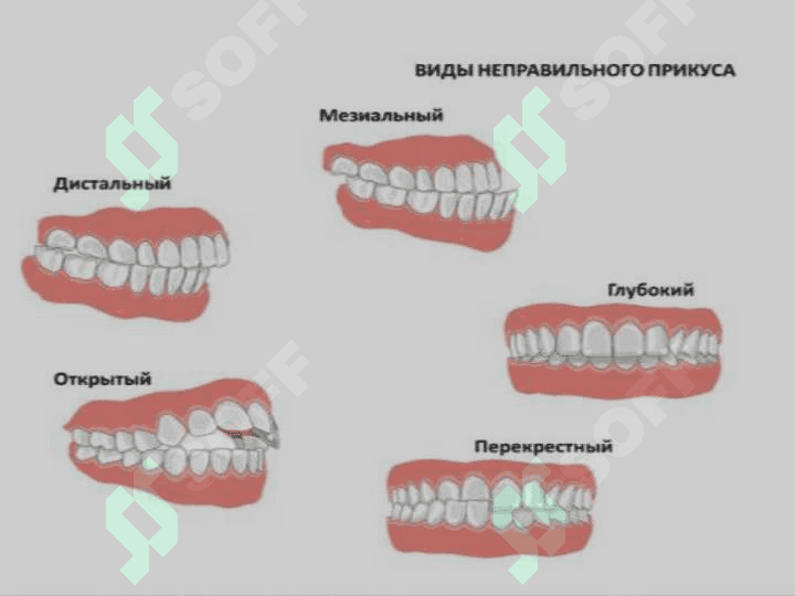 Нутқнинг товуш томонини текшириш технологияси 5