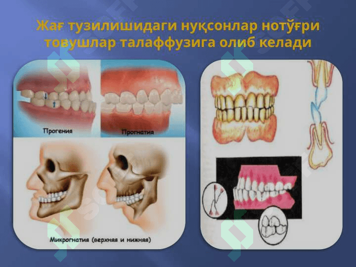 Нутқнинг товуш томонини текшириш технологияси 6