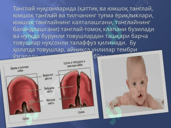 Нутқнинг товуш томонини текшириш технологияси 7