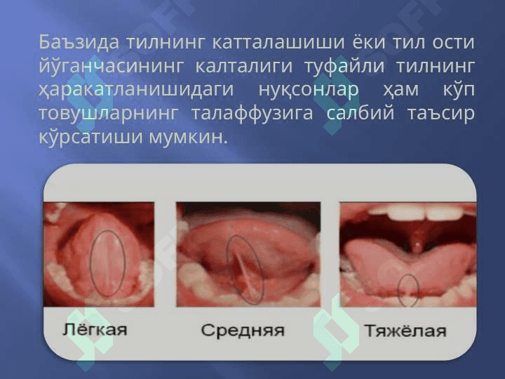 Нутқнинг товуш томонини текшириш технологияси 8